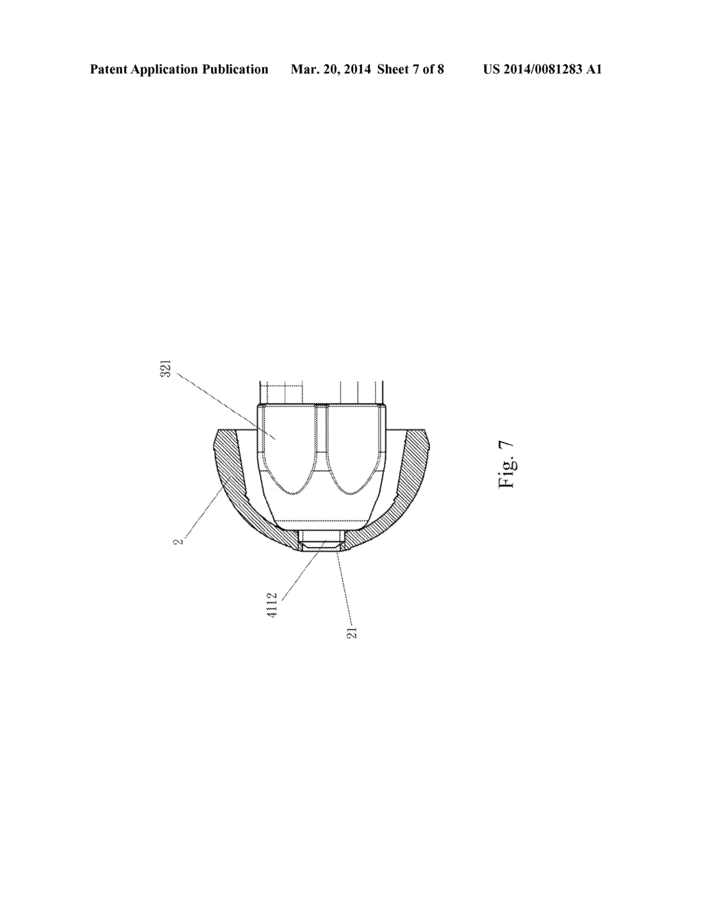 SURGICAL INSTRUMENT FOR ACETABULAR CUP IMPLANTATION - diagram, schematic, and image 08