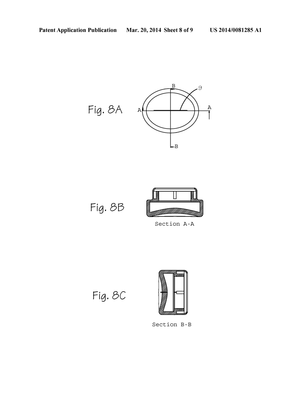 Method and Devices for Implantation of Biologic Constructs - diagram, schematic, and image 09