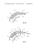 LEAD REMOVAL SLEEVE diagram and image