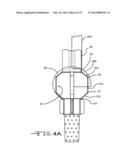 ENDOLUMENAL RESTRICTION METHOD AND APPARATUS diagram and image