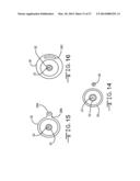 ENDOLUMENAL RESTRICTION METHOD AND APPARATUS diagram and image