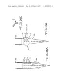 ENDOLUMENAL RESTRICTION METHOD AND APPARATUS diagram and image