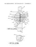 ENDOLUMENAL RESTRICTION METHOD AND APPARATUS diagram and image