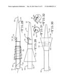 ENDOLUMENAL RESTRICTION METHOD AND APPARATUS diagram and image