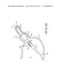 ENDOLUMENAL RESTRICTION METHOD AND APPARATUS diagram and image