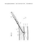 TISSUE CLOSURE DEVICES, DEVICE AND SYSTEMS FOR DELIVERY, KITS AND METHODS     THEREFOR diagram and image