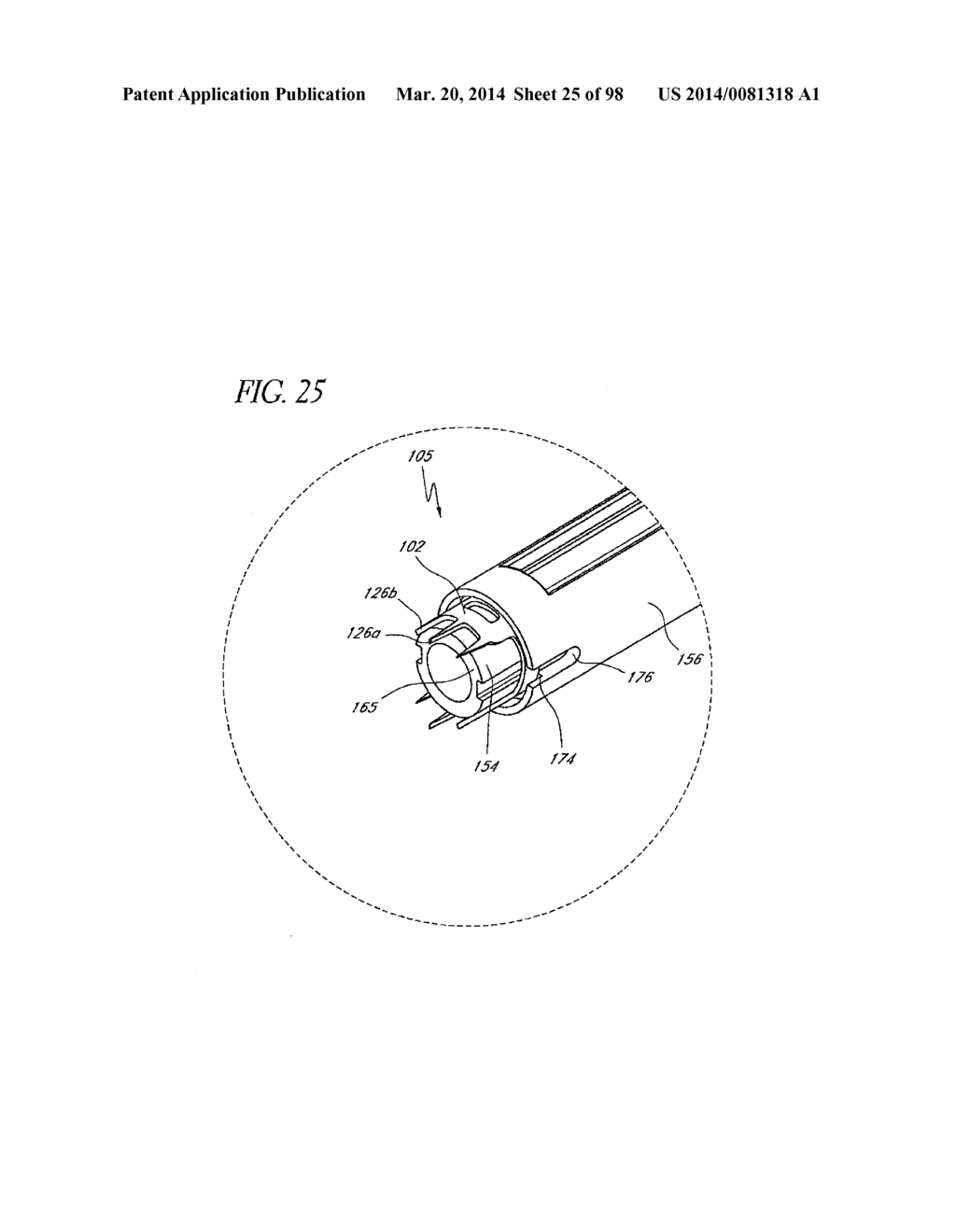 TISSUE CLOSURE DEVICES, DEVICE AND SYSTEMS FOR DELIVERY, KITS AND METHODS     THEREFOR - diagram, schematic, and image 26