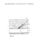 TISSUE CLOSURE DEVICES, DEVICE AND SYSTEMS FOR DELIVERY, KITS AND METHODS     THEREFOR diagram and image