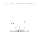 TISSUE CLOSURE DEVICES, DEVICE AND SYSTEMS FOR DELIVERY, KITS AND METHODS     THEREFOR diagram and image