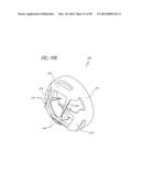 TISSUE CLOSURE DEVICES, DEVICE AND SYSTEMS FOR DELIVERY, KITS AND METHODS     THEREFOR diagram and image