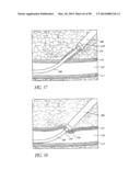 TISSUE CLOSURE DEVICES, DEVICE AND SYSTEMS FOR DELIVERY, KITS AND METHODS     THEREFOR diagram and image