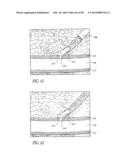 TISSUE CLOSURE DEVICES, DEVICE AND SYSTEMS FOR DELIVERY, KITS AND METHODS     THEREFOR diagram and image