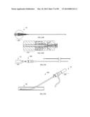 TISSUE CLOSURE DEVICES, DEVICE AND SYSTEMS FOR DELIVERY, KITS AND METHODS     THEREFOR diagram and image