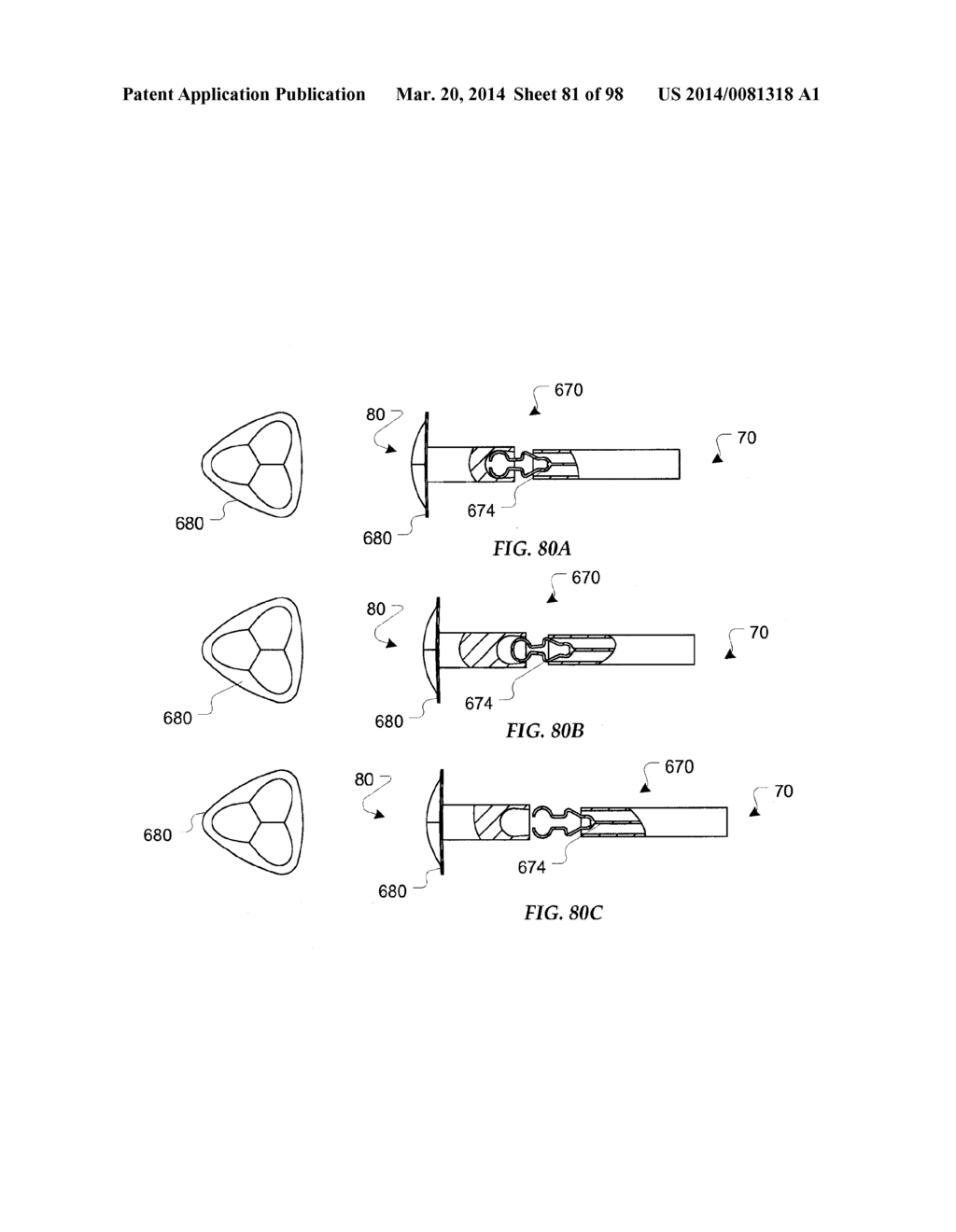 TISSUE CLOSURE DEVICES, DEVICE AND SYSTEMS FOR DELIVERY, KITS AND METHODS     THEREFOR - diagram, schematic, and image 82