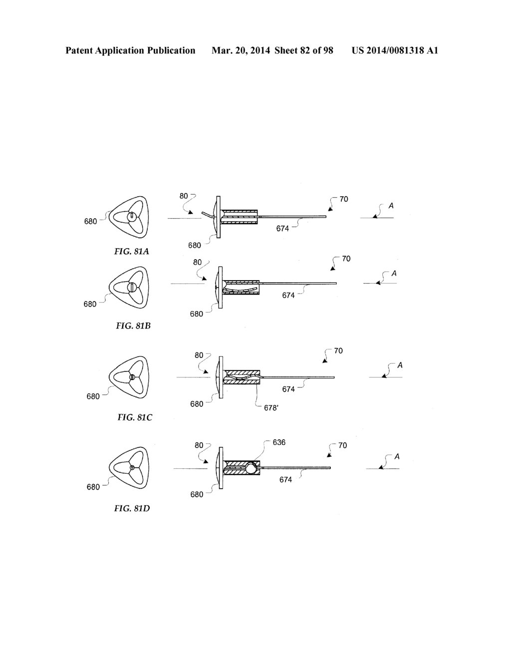 TISSUE CLOSURE DEVICES, DEVICE AND SYSTEMS FOR DELIVERY, KITS AND METHODS     THEREFOR - diagram, schematic, and image 83