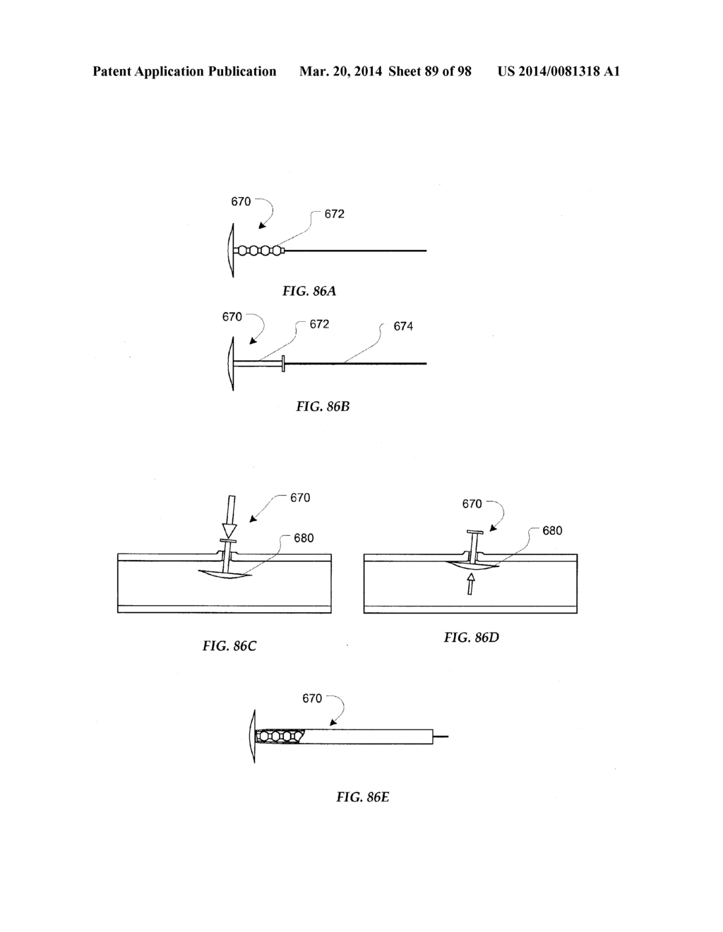 TISSUE CLOSURE DEVICES, DEVICE AND SYSTEMS FOR DELIVERY, KITS AND METHODS     THEREFOR - diagram, schematic, and image 90