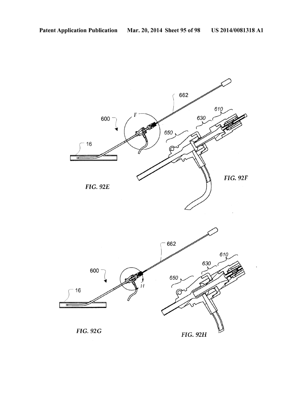 TISSUE CLOSURE DEVICES, DEVICE AND SYSTEMS FOR DELIVERY, KITS AND METHODS     THEREFOR - diagram, schematic, and image 96