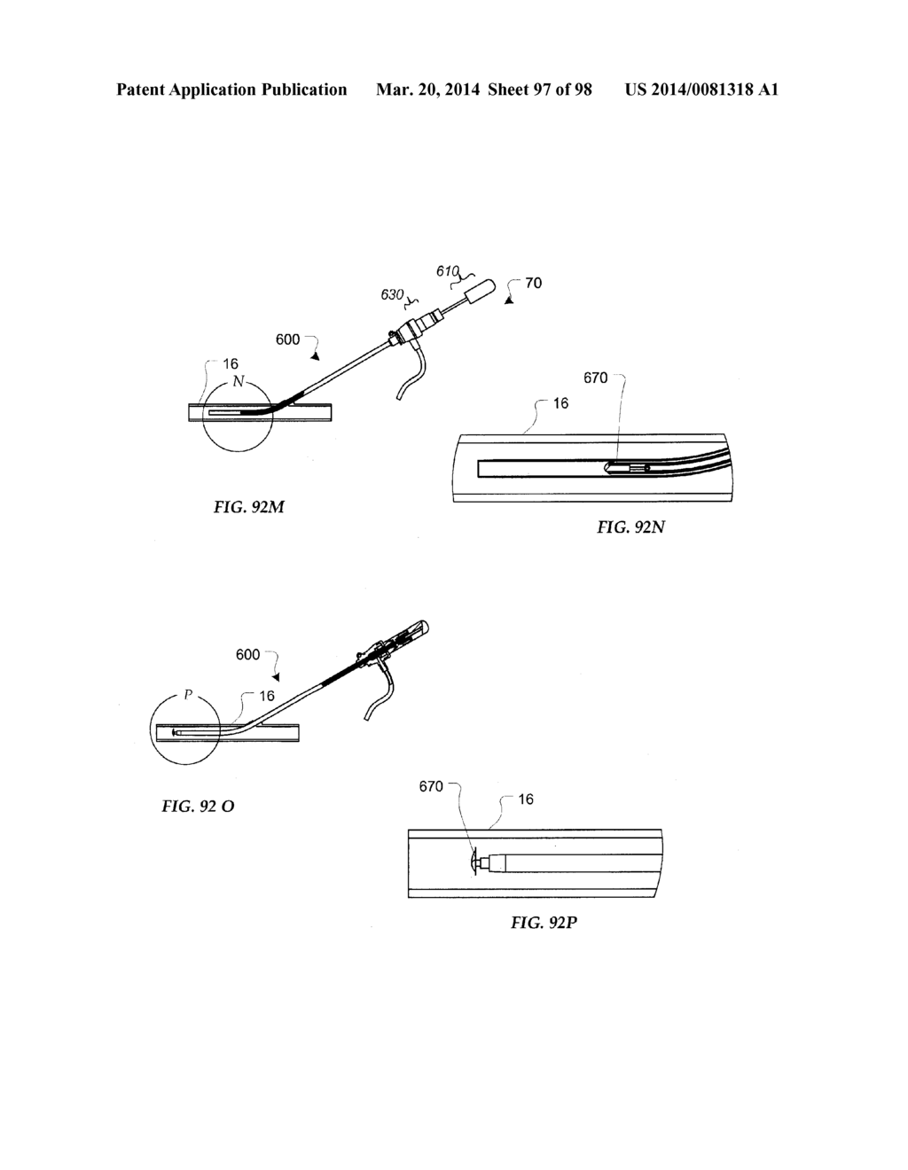 TISSUE CLOSURE DEVICES, DEVICE AND SYSTEMS FOR DELIVERY, KITS AND METHODS     THEREFOR - diagram, schematic, and image 98