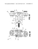 Spinous Process Fixation System and Methods Thereof diagram and image