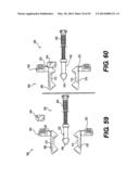 Spinous Process Fixation System and Methods Thereof diagram and image