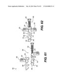 Spinous Process Fixation System and Methods Thereof diagram and image