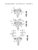 Spinous Process Fixation System and Methods Thereof diagram and image