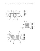 Spinous Process Fixation System and Methods Thereof diagram and image