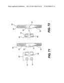 Spinous Process Fixation System and Methods Thereof diagram and image