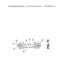 Spinous Process Fixation System and Methods Thereof diagram and image