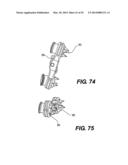 Spinous Process Fixation System and Methods Thereof diagram and image