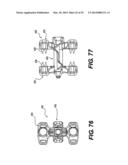 Spinous Process Fixation System and Methods Thereof diagram and image