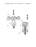 Spinous Process Fixation System and Methods Thereof diagram and image