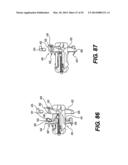 Spinous Process Fixation System and Methods Thereof diagram and image