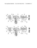 Spinous Process Fixation System and Methods Thereof diagram and image