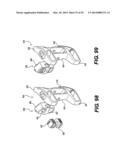 Spinous Process Fixation System and Methods Thereof diagram and image