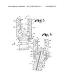 Dynamic stabilization medical implant assembles and methods diagram and image