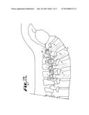 Dynamic stabilization medical implant assembles and methods diagram and image