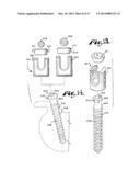 Dynamic stabilization medical implant assembles and methods diagram and image