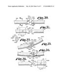 Dynamic stabilization medical implant assembles and methods diagram and image