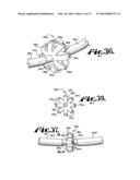 Dynamic stabilization medical implant assembles and methods diagram and image