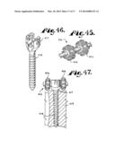 Dynamic stabilization medical implant assembles and methods diagram and image