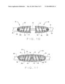 Apparatus And Method For Sternal Closure diagram and image