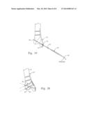 FASTENING SYSTEM FOR INTERNAL FIXATION diagram and image