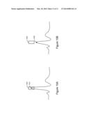 CARDIAC WAVEFORM TEMPLATE CREATION, MAINTENANCE AND USE diagram and image