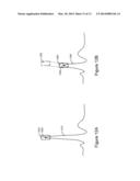 CARDIAC WAVEFORM TEMPLATE CREATION, MAINTENANCE AND USE diagram and image