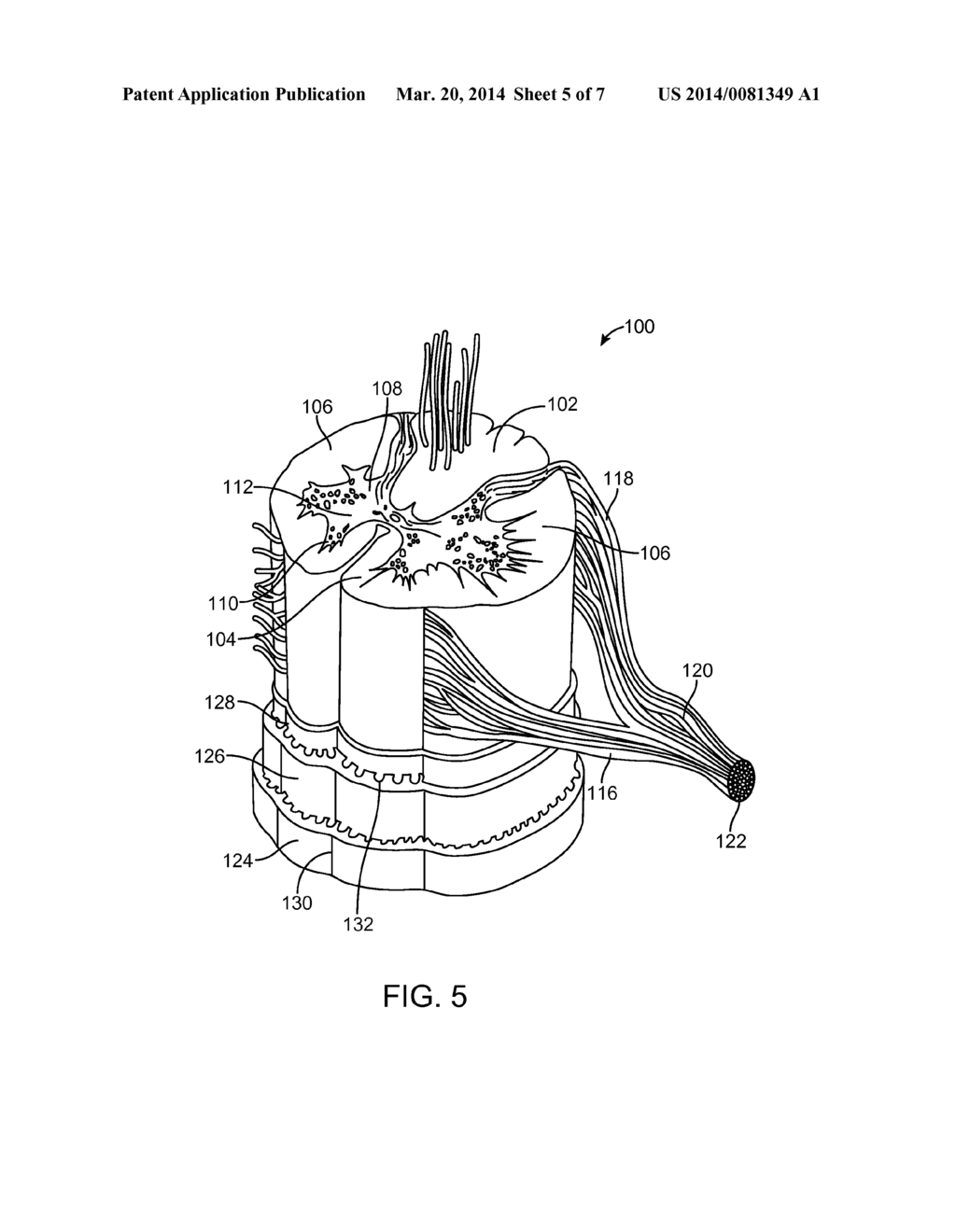 METHOD FOR SELECTIVELY MODULATING NEURAL ELEMENTS IN THE DORSAL HORN - diagram, schematic, and image 06