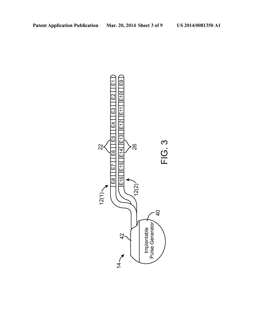 METHOD FOR ESTIMATING DESIRED STIMULATION AMPLITUDE FOR ELECTRODE     CONFIGURATION - diagram, schematic, and image 04