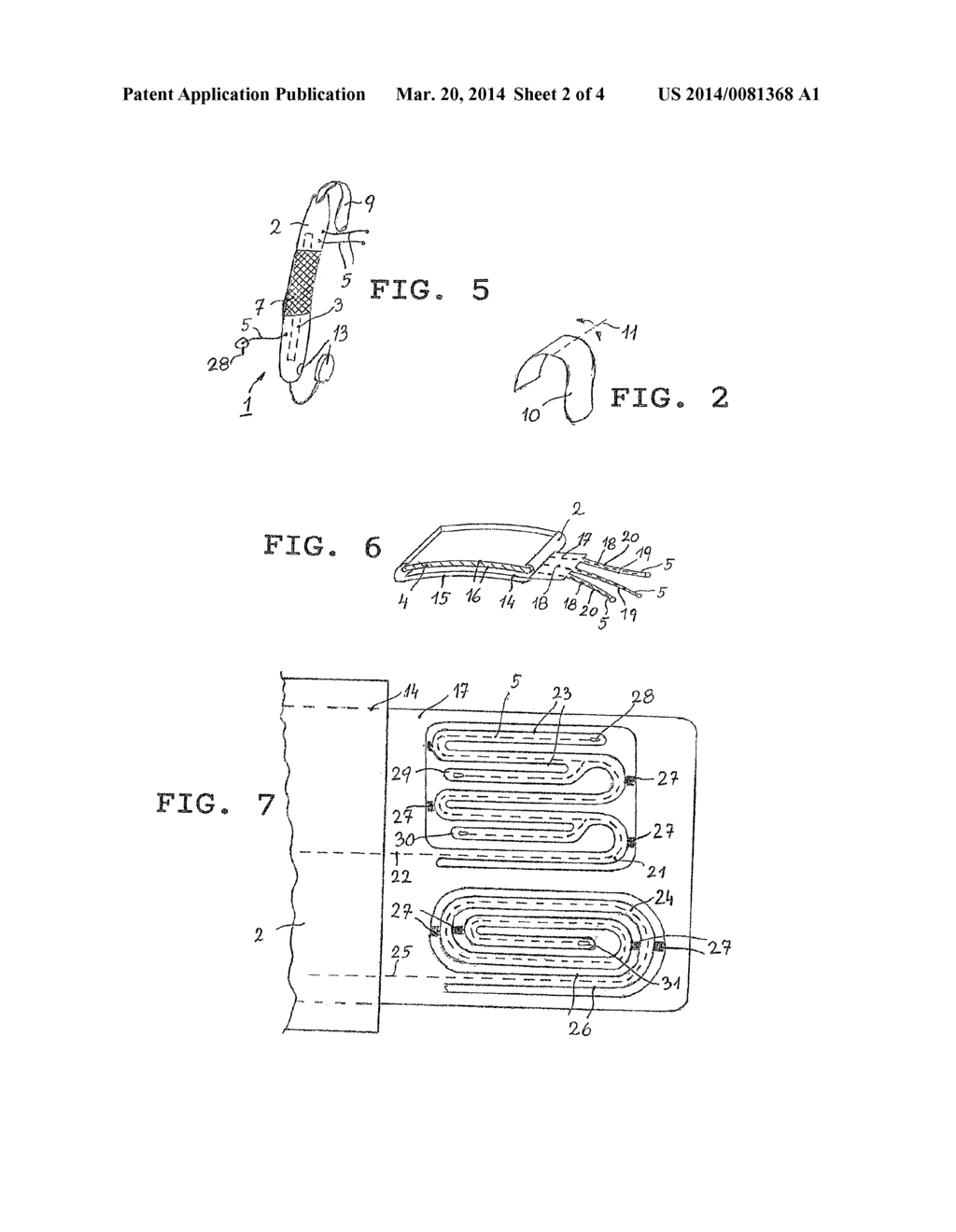 PUNCTUAL STIMULATION DEVICE - diagram, schematic, and image 03