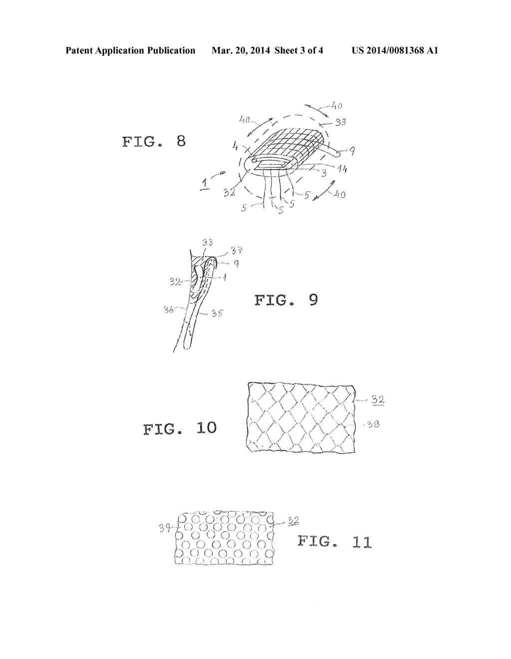 PUNCTUAL STIMULATION DEVICE - diagram, schematic, and image 04