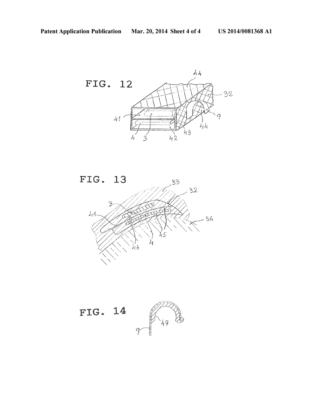 PUNCTUAL STIMULATION DEVICE - diagram, schematic, and image 05